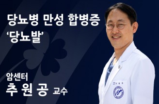 [당뇨병 만성 합병증 ‘당뇨발’] 당뇨 없는 세상에서 당당하게 걸으려면