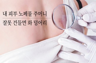 [표피낭종] 내 피부 노폐물 주머니, 잘못 건들면 화 덩어리